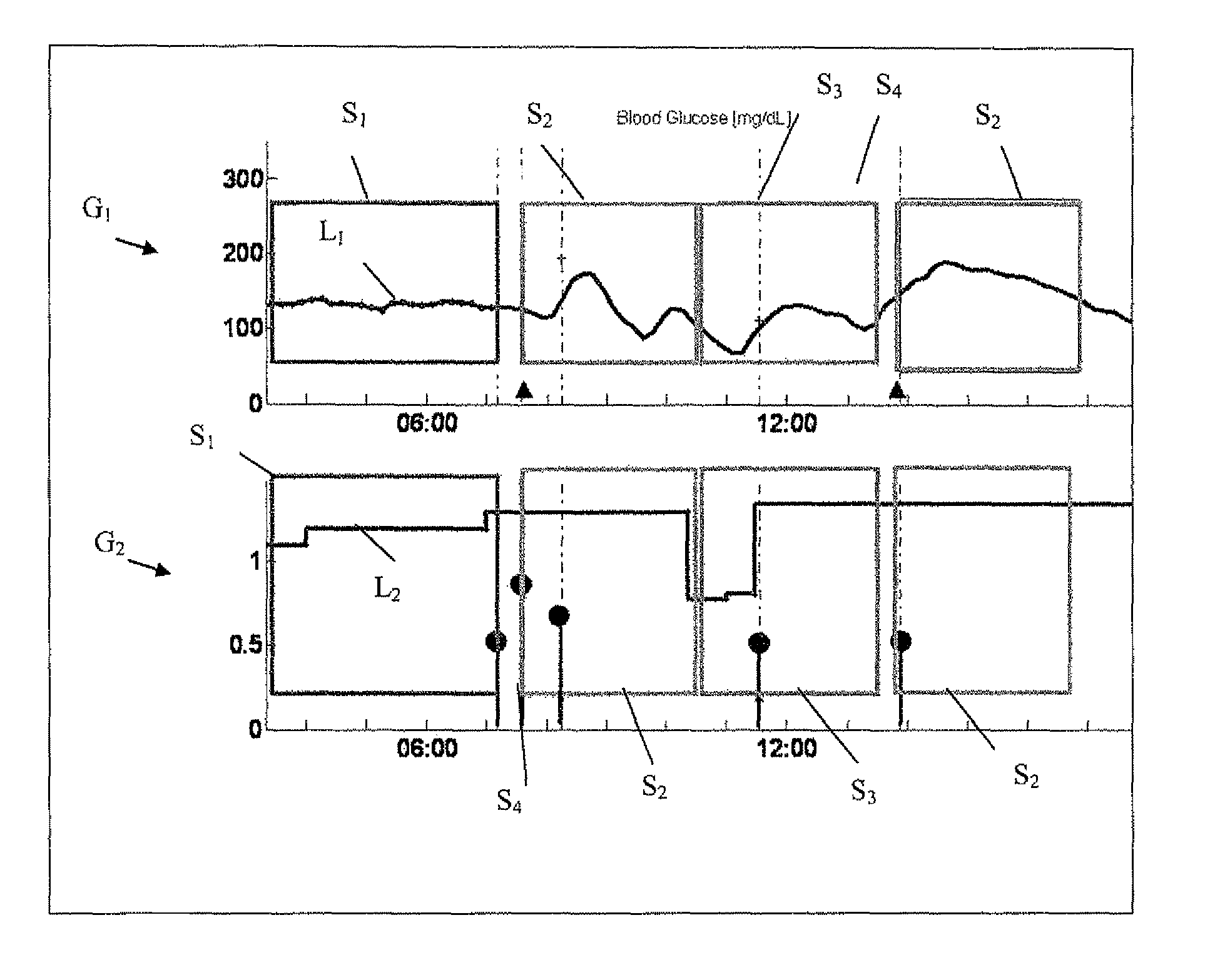 Monitoring device for management of insulin delivery