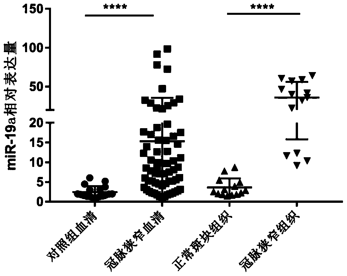 Serum miRNA detection kit related to coronary artery stenosis and application thereof