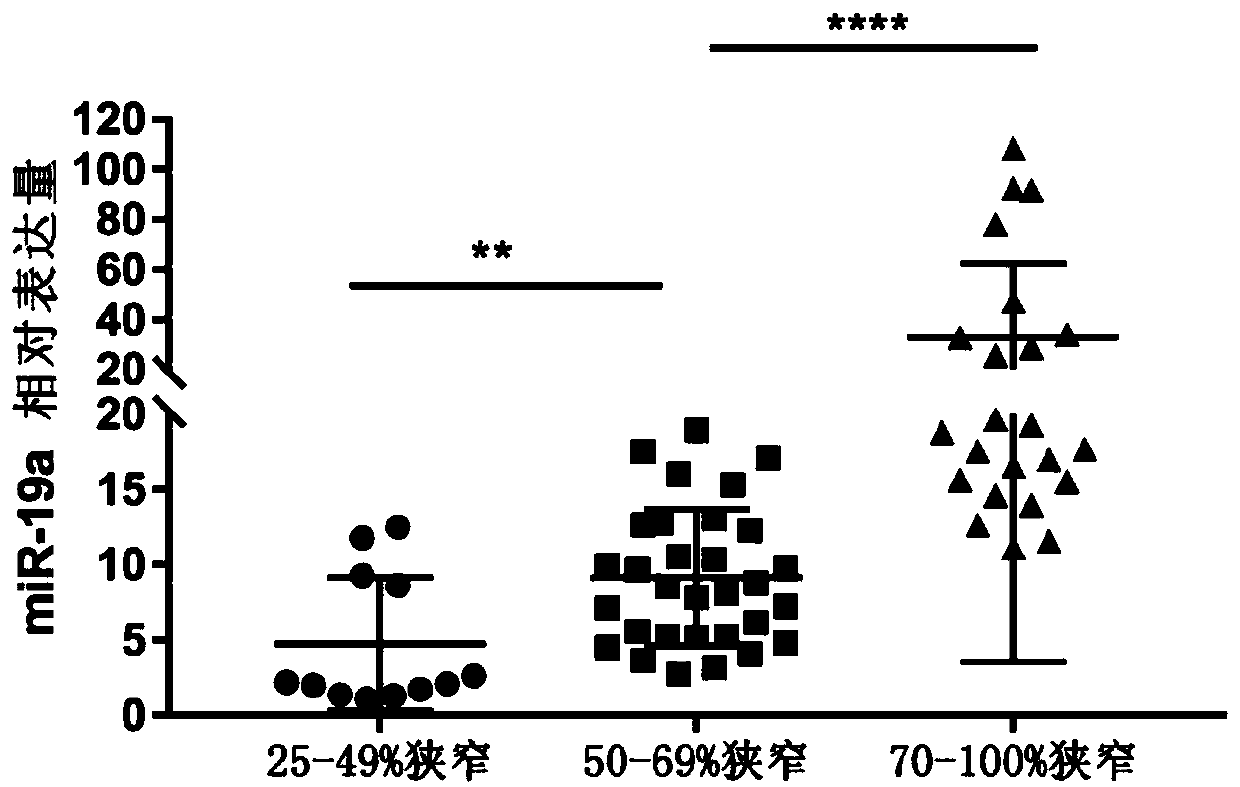 Serum miRNA detection kit related to coronary artery stenosis and application thereof