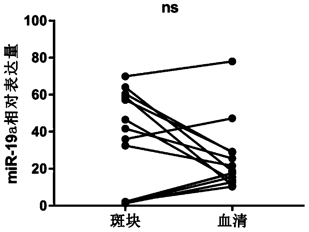 Serum miRNA detection kit related to coronary artery stenosis and application thereof