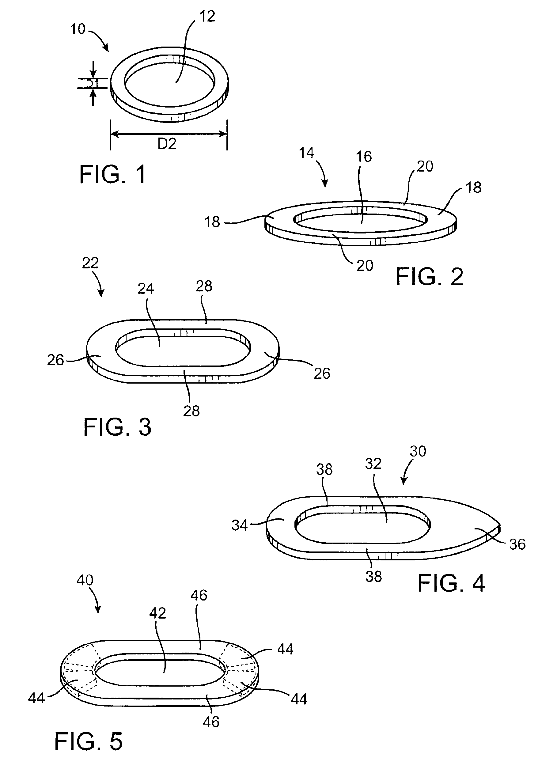 Methods and devices using magnetic force to form an anastomosis between hollow bodies