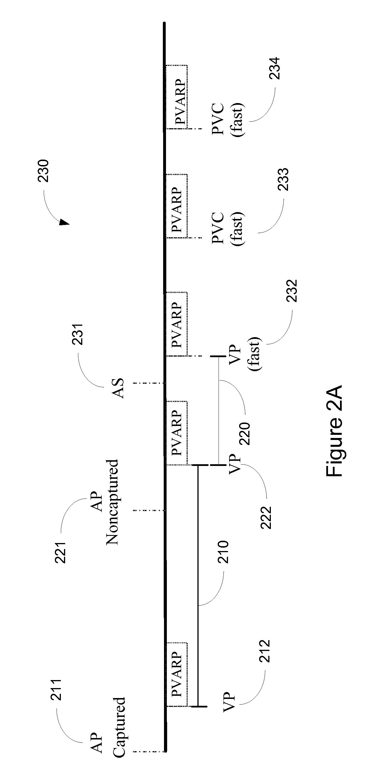 Methods and Systems for Mitigating the Occurrence of Arrhythmia During Atrial Pacing