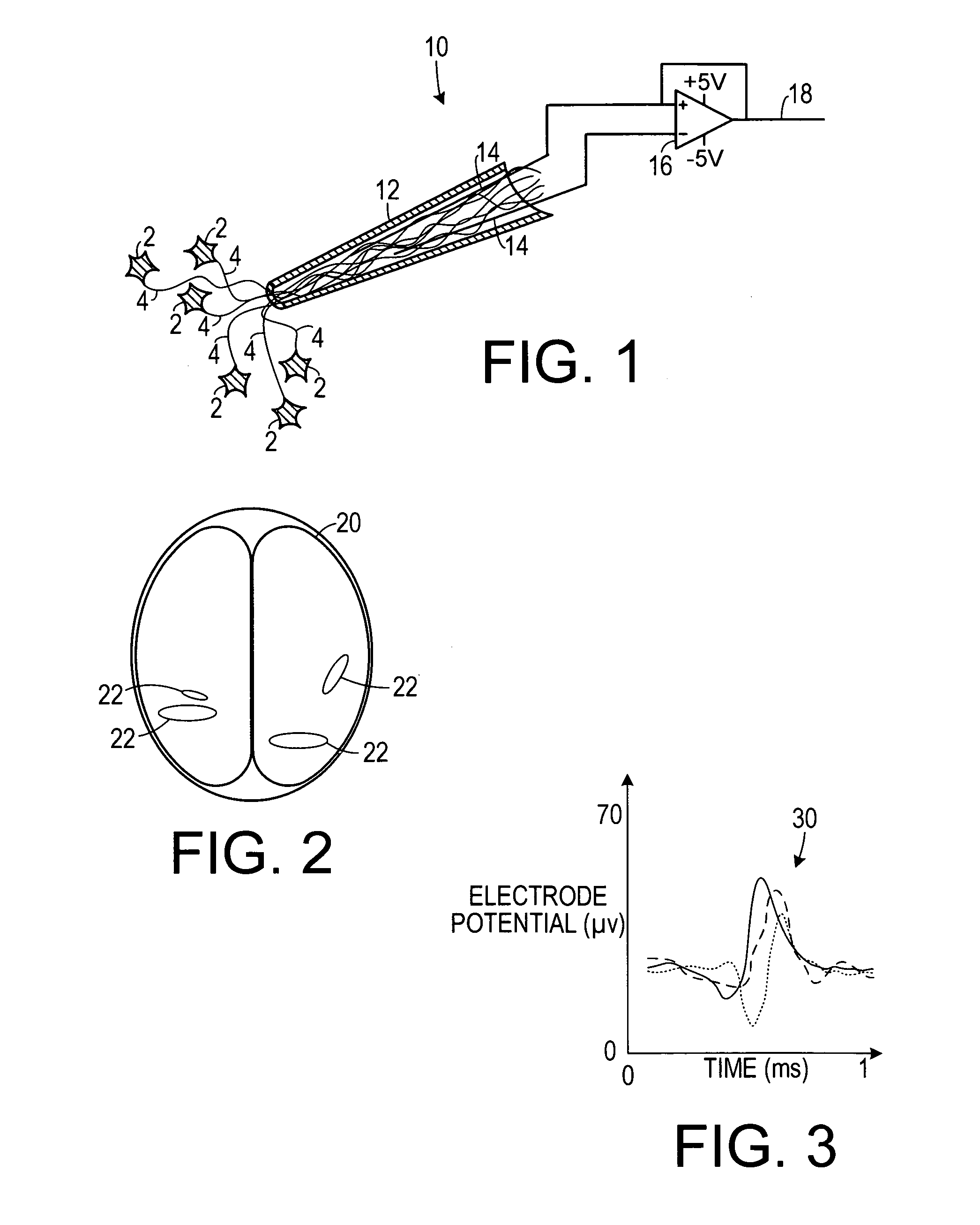 System and method for speech generation from brain activity
