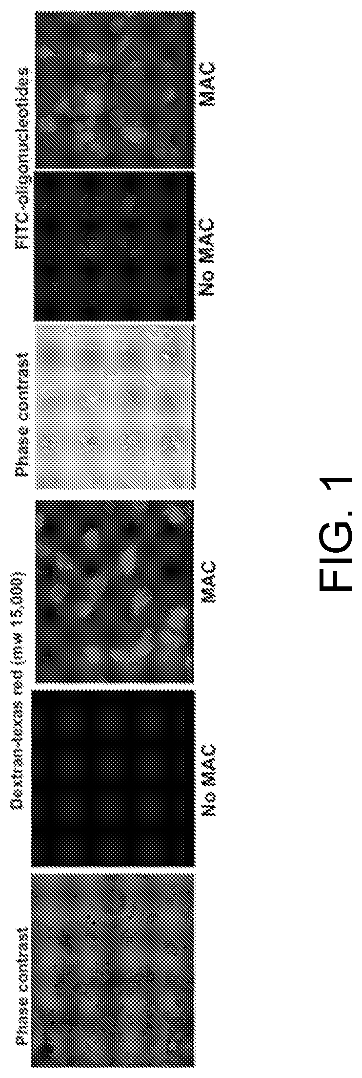 Membrane attack complexes and uses thereof