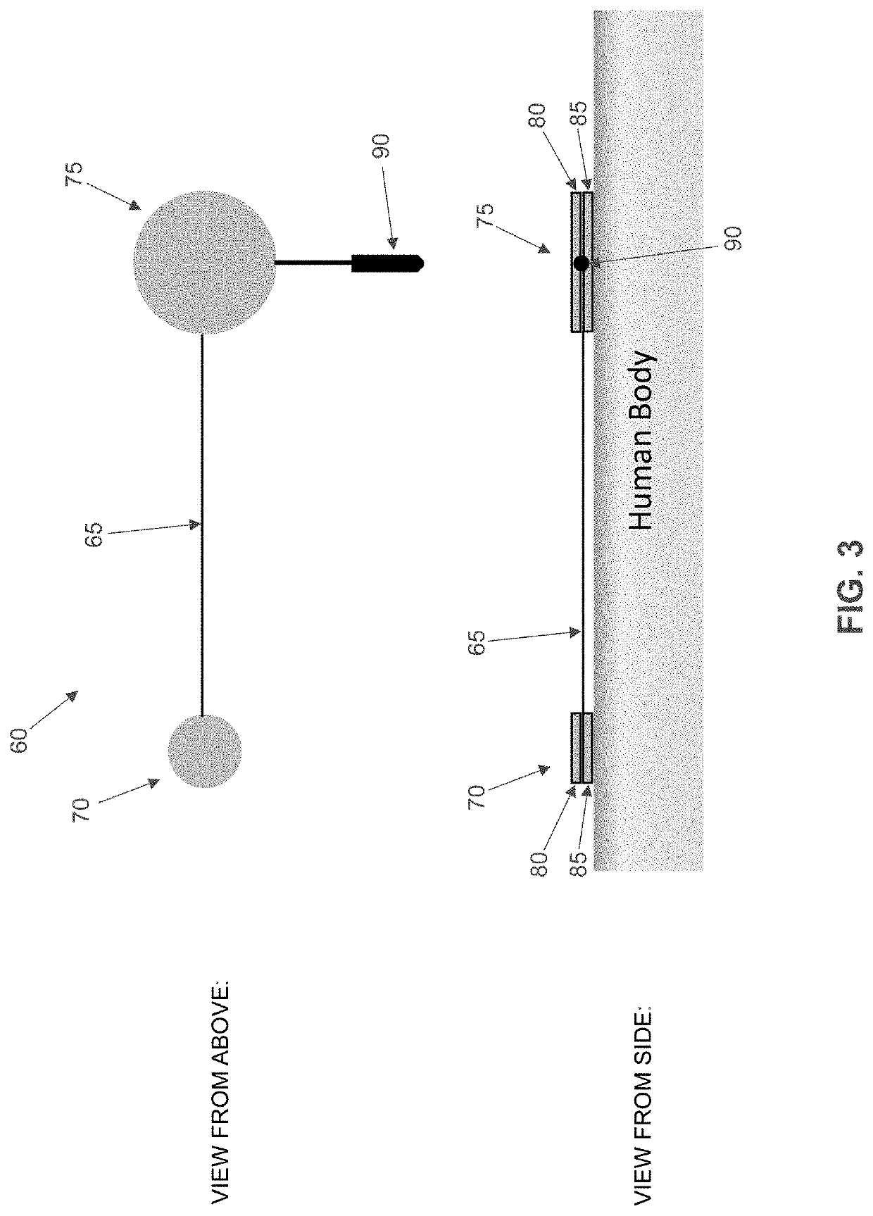 Method and apparatus for performing electroretinography, including enhanced electrode