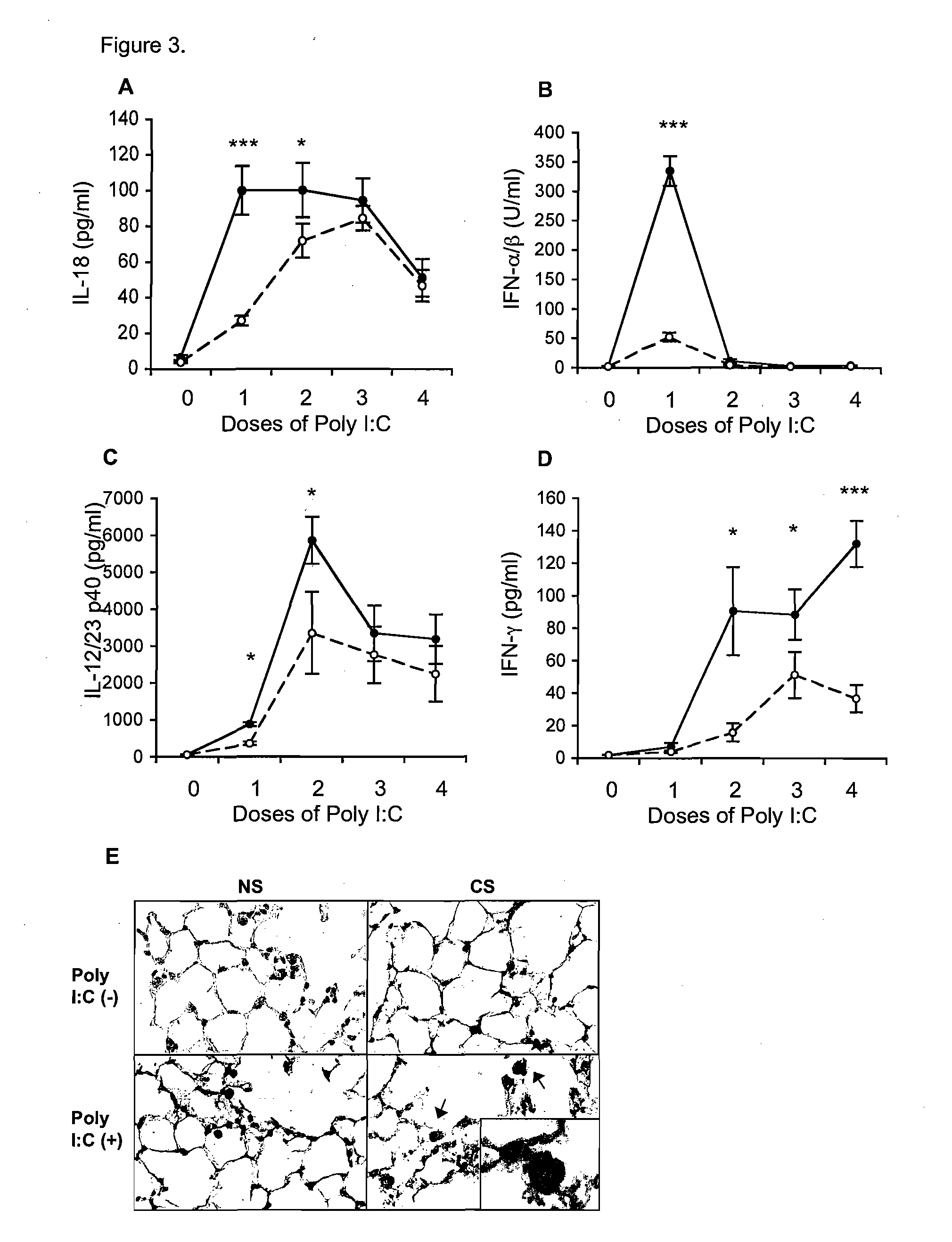 IL-18 and Protein Kinase R Inhibition for the Treatment of COPD