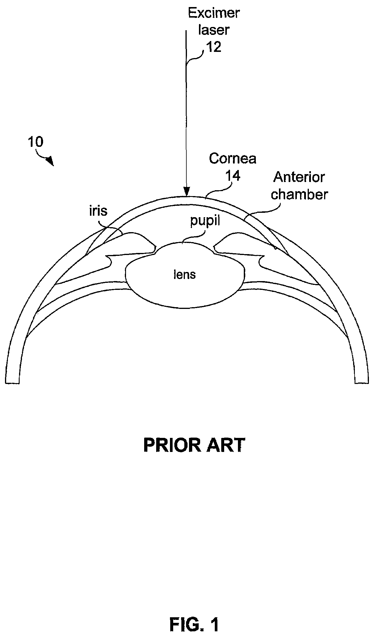 Determining optimal positioning of ophthalmic devices by use of image processing and autofocusing techniques