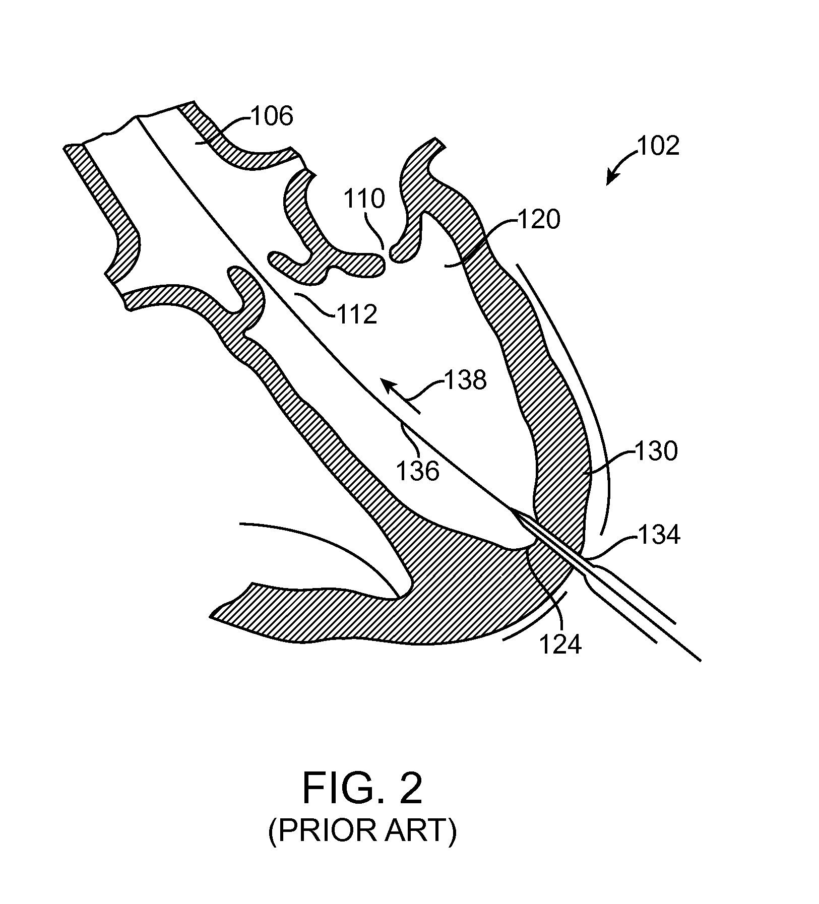 System and method for providing access and closure to tissue