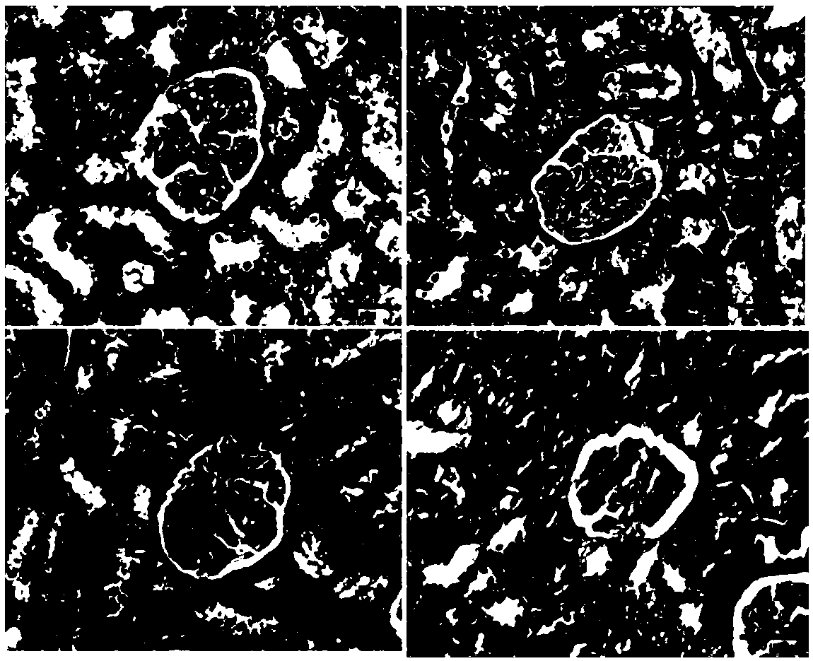 Application of paeoniflorin-6-O'-benzenesulfonate