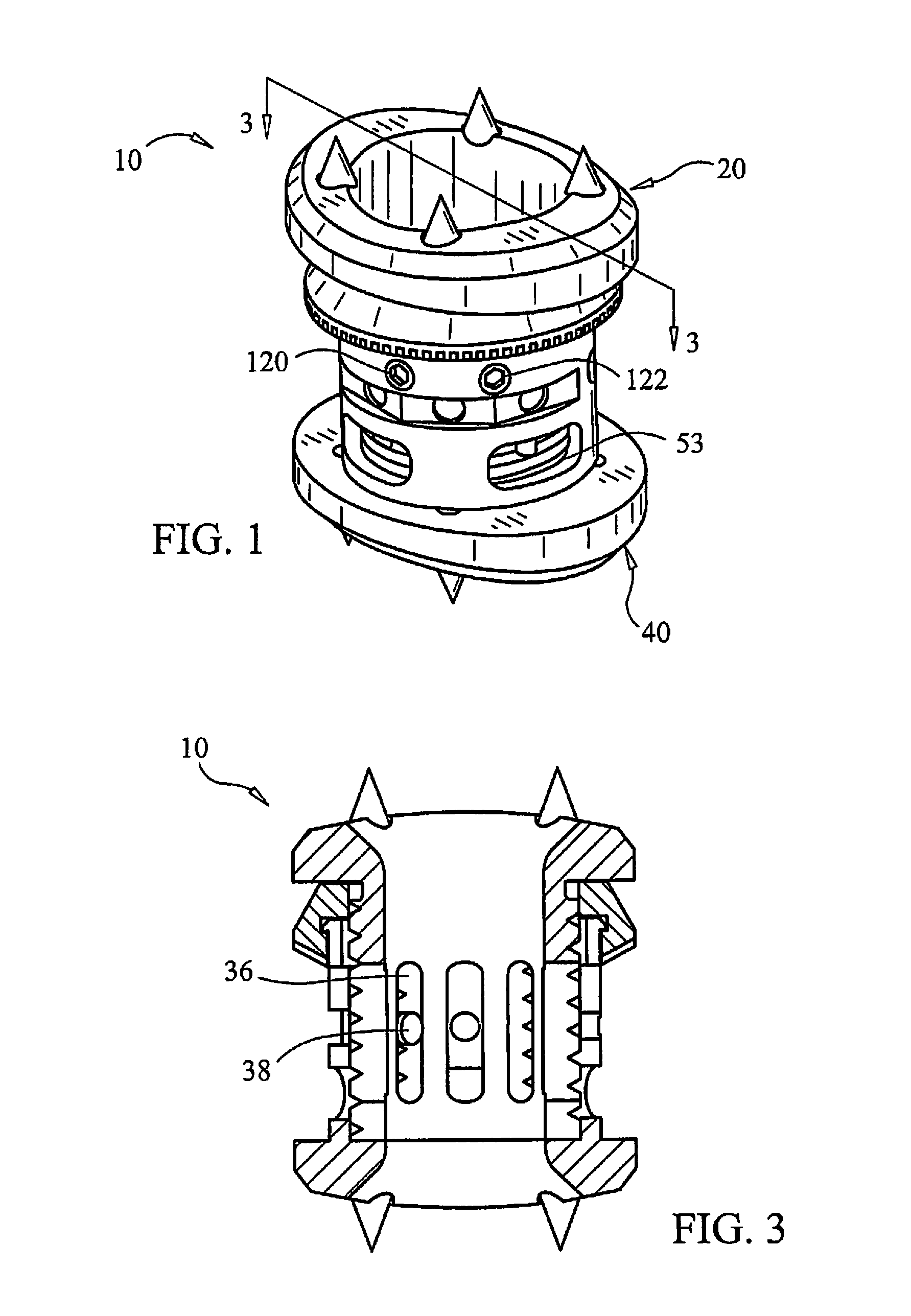 Expandable Vertebral Prosthesis