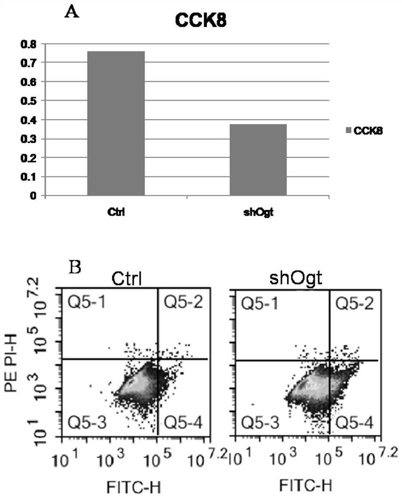 Application of OGT as target in preparation of medicine for treating abnormal secretion of glucagon in diabetes