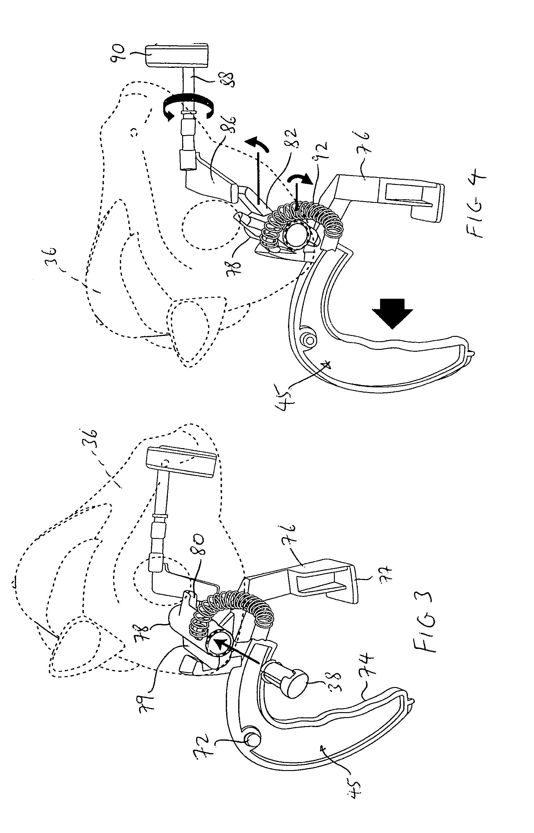 Bubble generating assembly