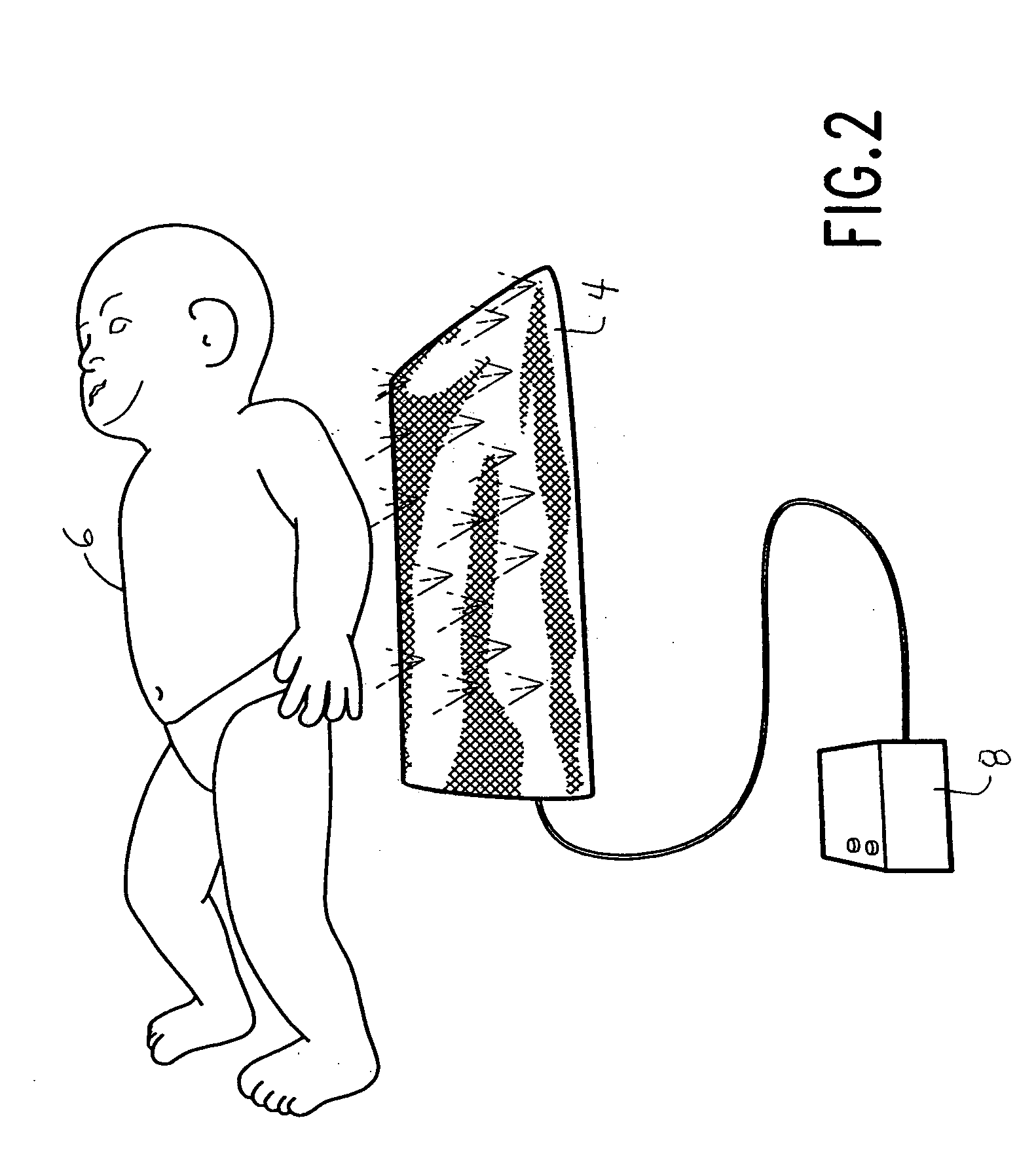 Device and method for phototherapy of jaundiced infants
