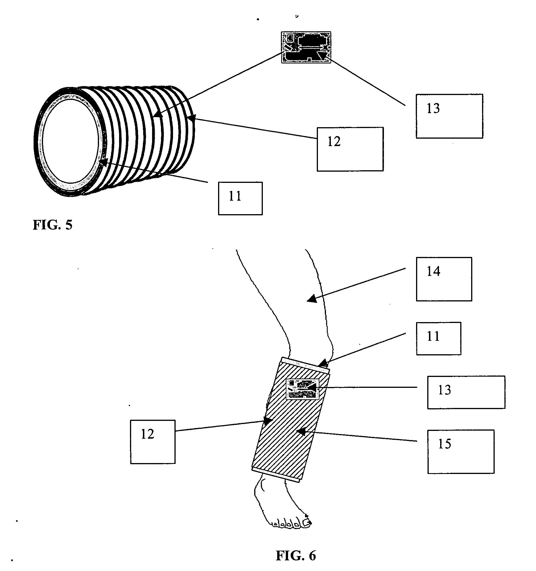 Apparatus for enhancing tissue repair in mammals