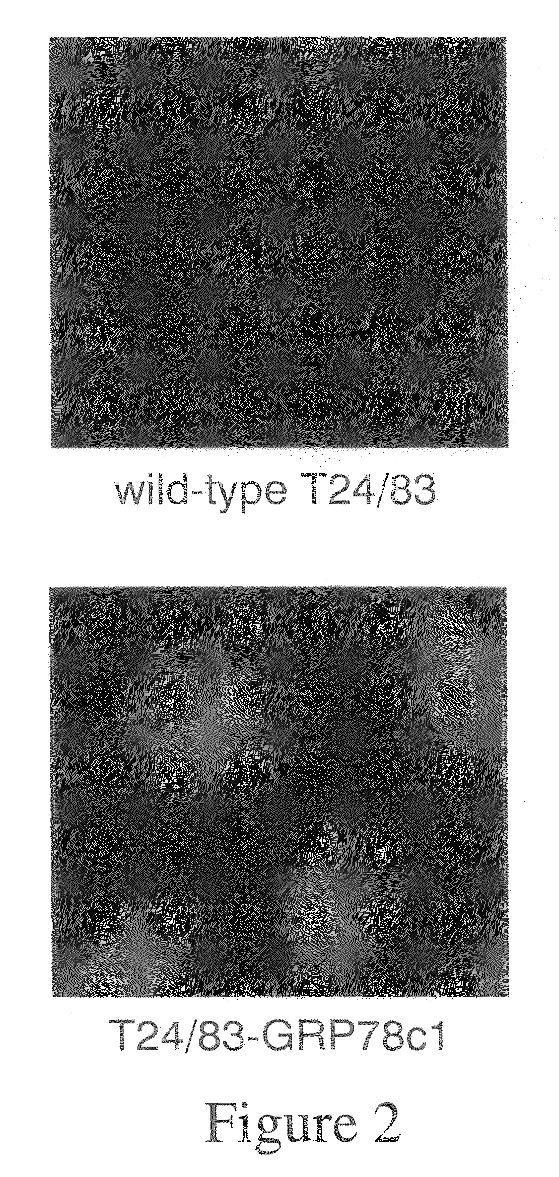 Method of inhibiting the generation of active thrombin on the surface of a cell within an atherosclerotic plaque