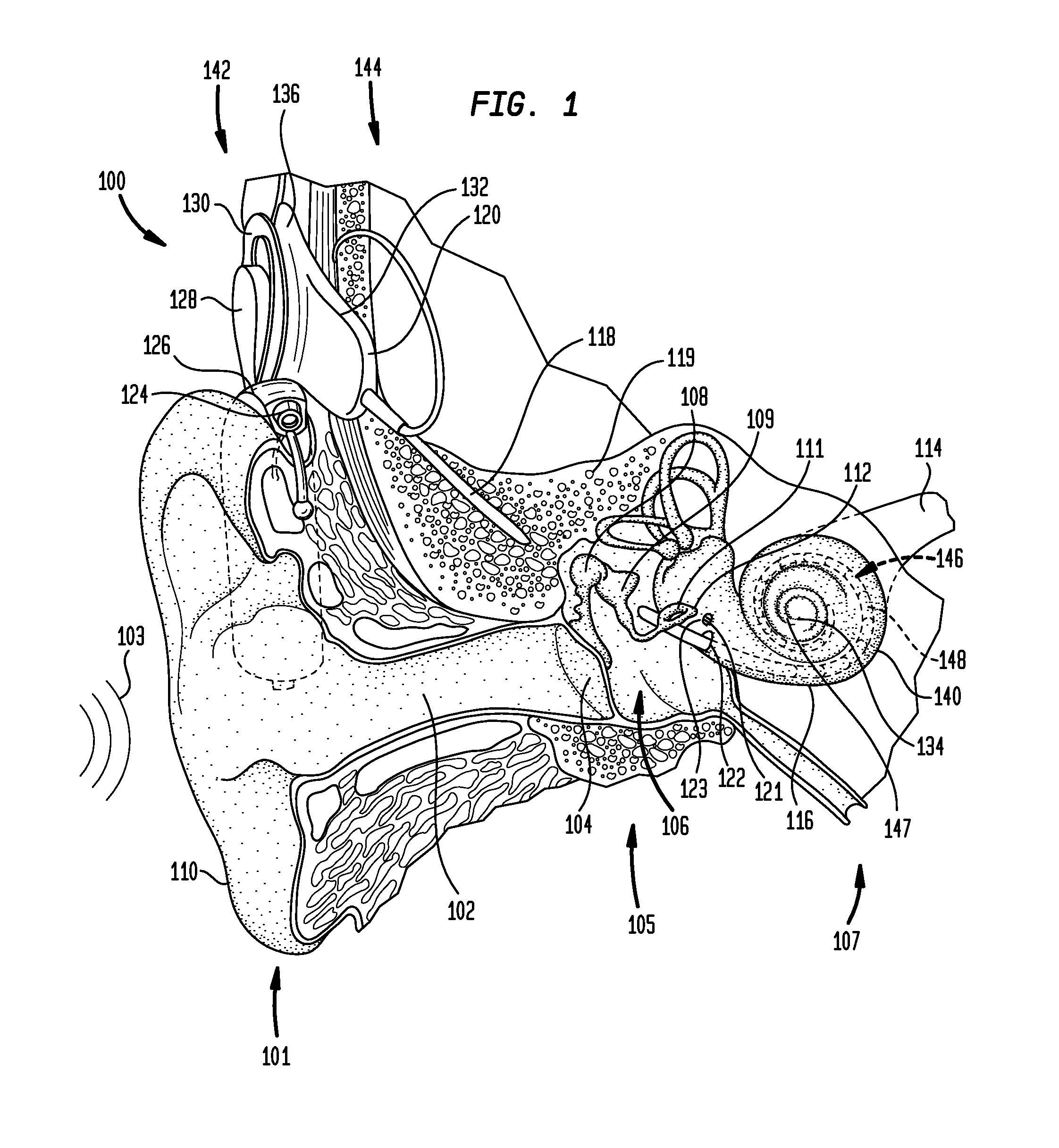 Sound processing with increased noise suppression