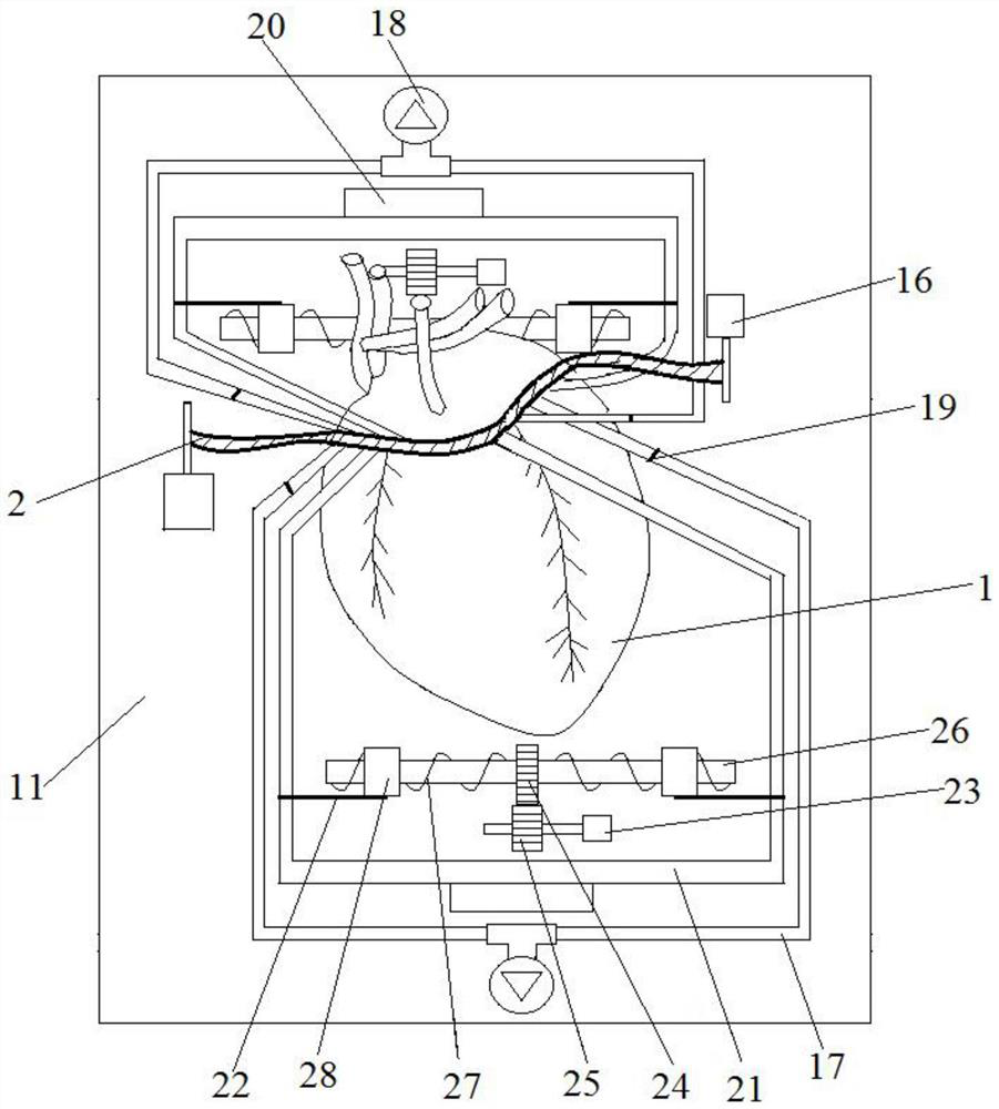 Display device for coronary atherosclerosis model