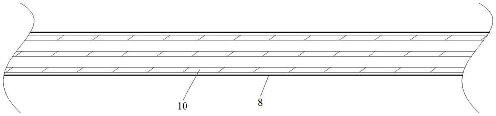 Display device for coronary atherosclerosis model