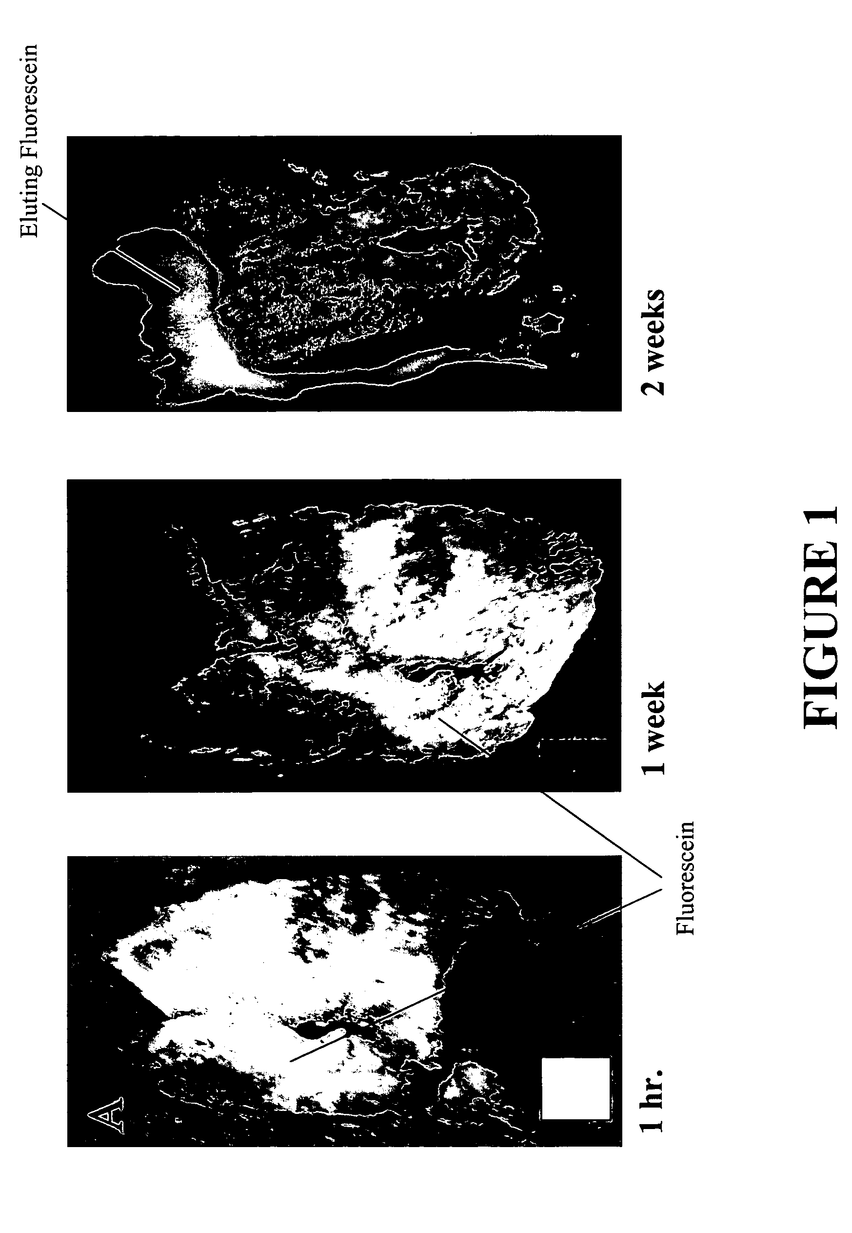 Method for the delivery of sustained release agents