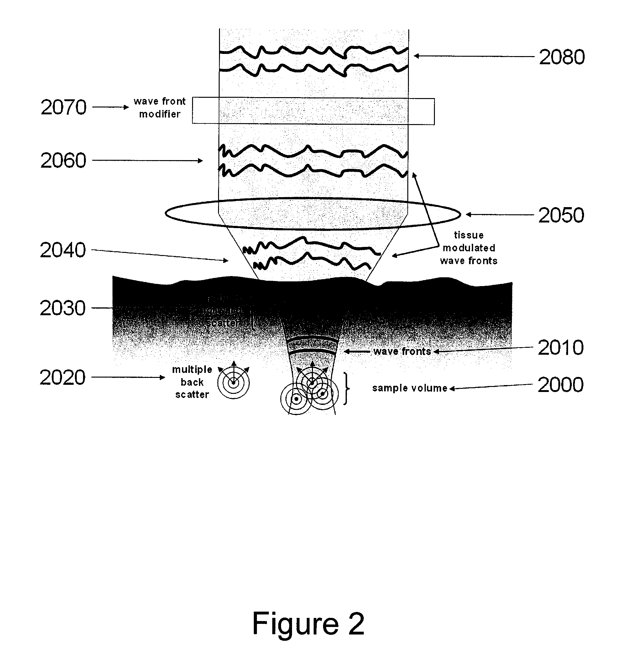 System, arrangement and process for providing speckle reductions using a wave front modulation for optical coherence tomography