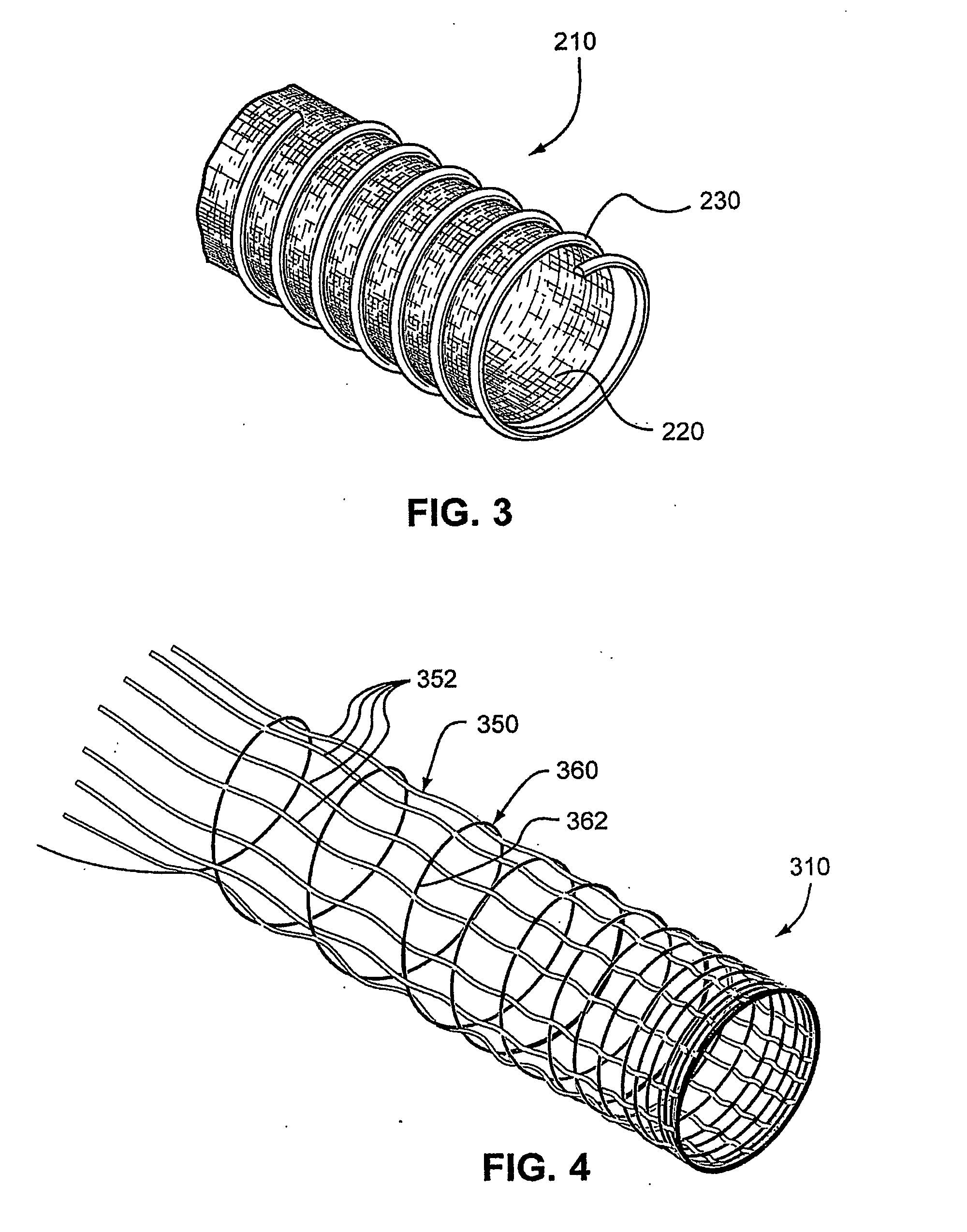Air Delivery Conduit
