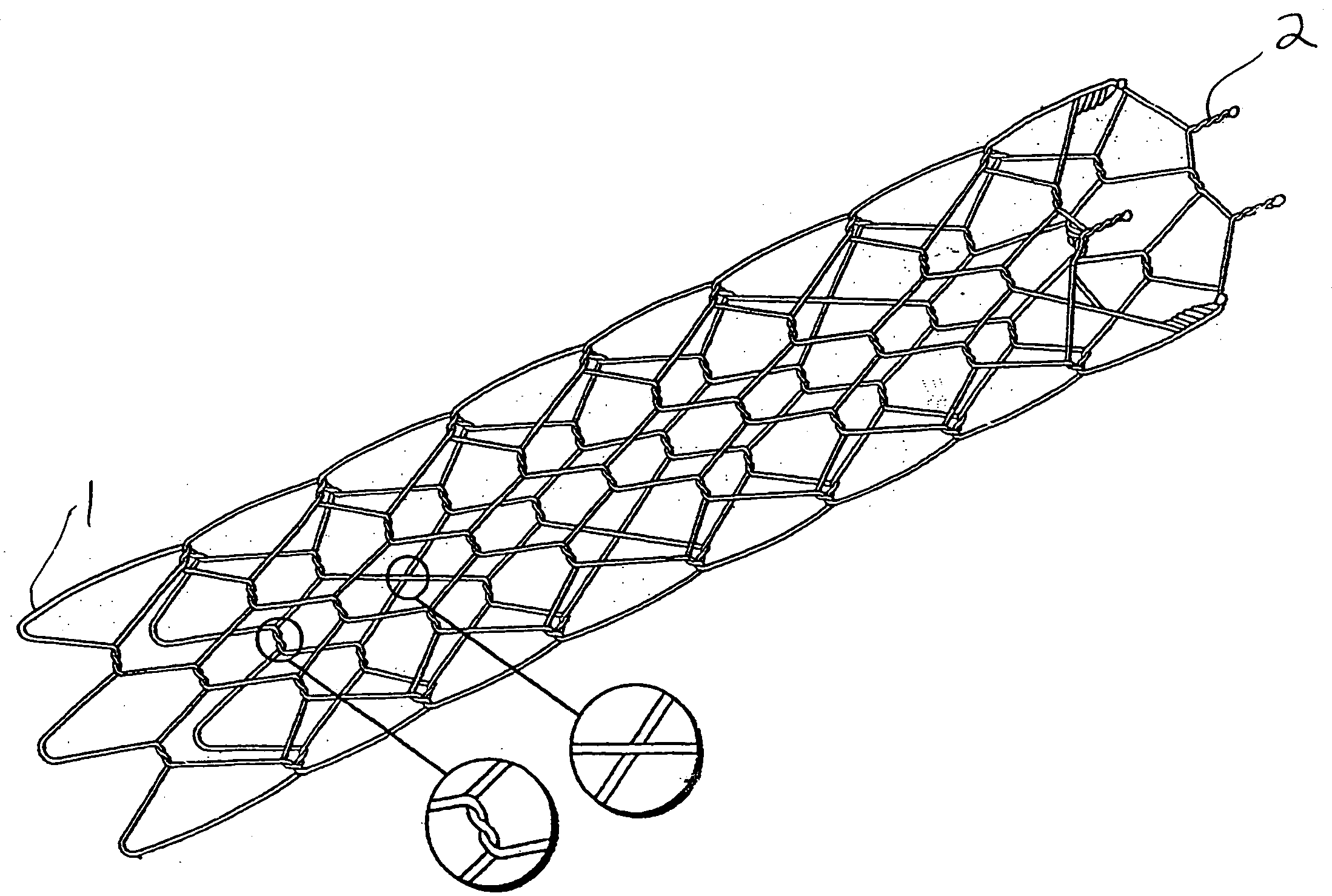 Stents with attached looped ends