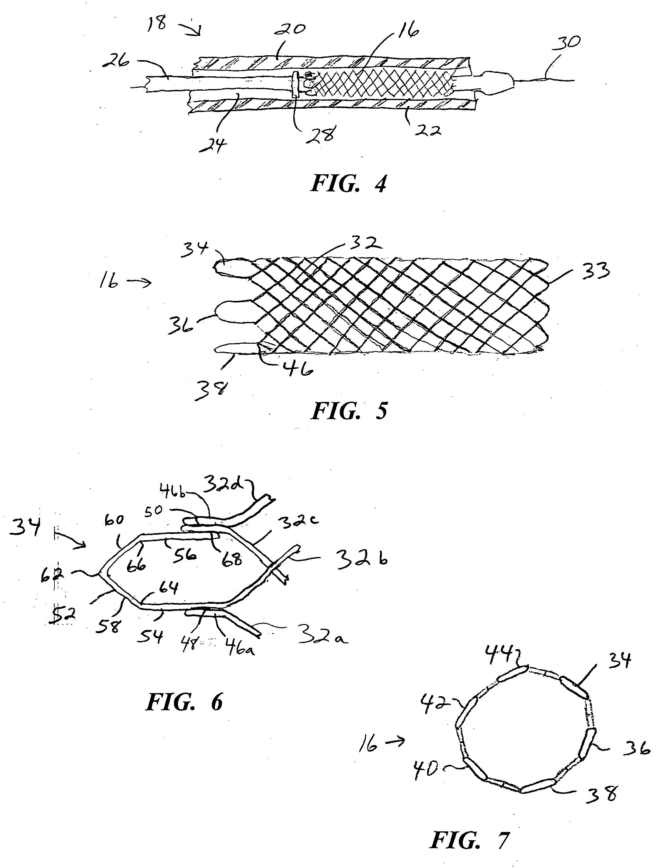 Stents with attached looped ends