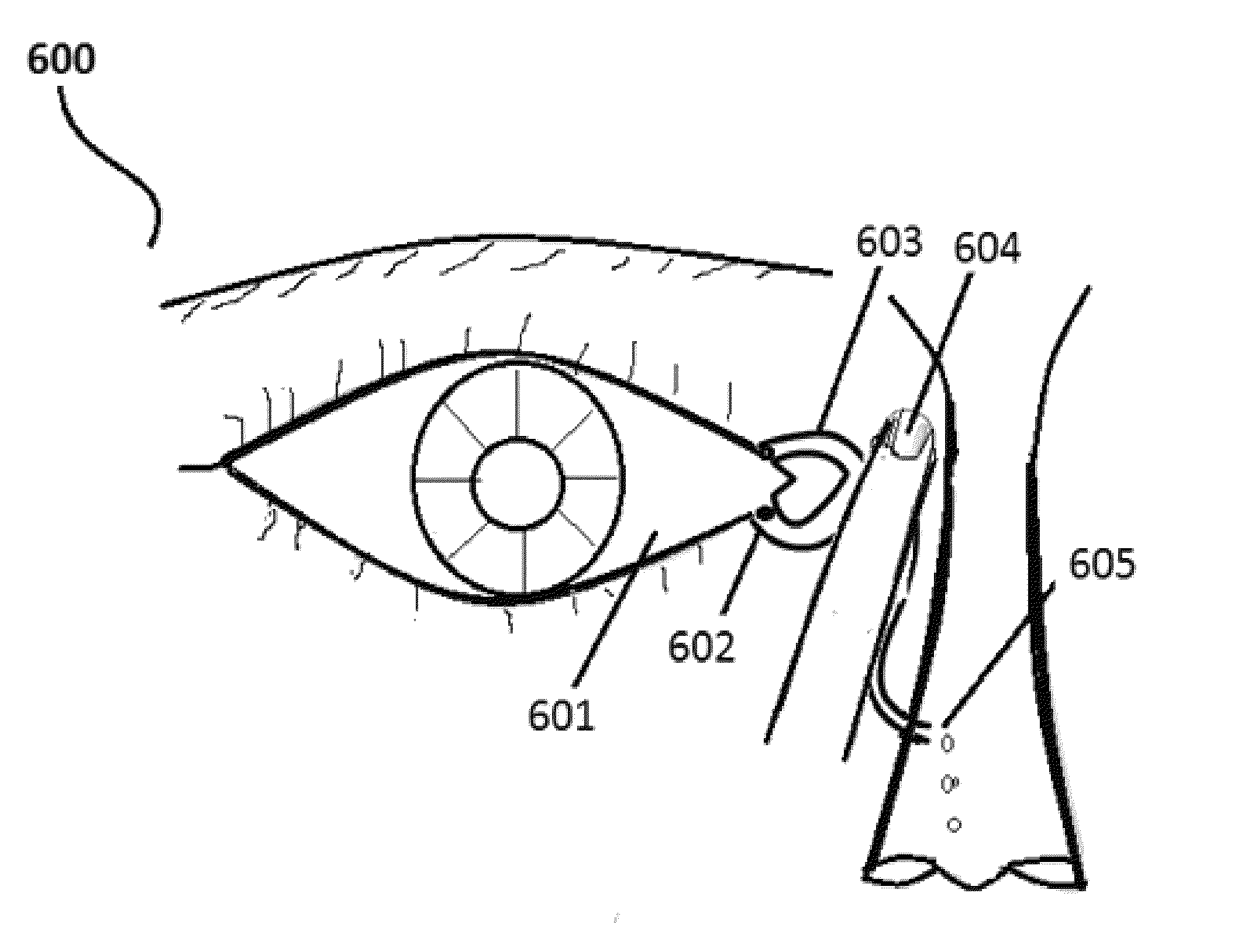 Method of treating glaucoma and intraocular hypertension