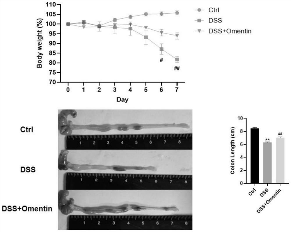 Application of retinol in preparation of medicine for treating inflammatory bowel disease