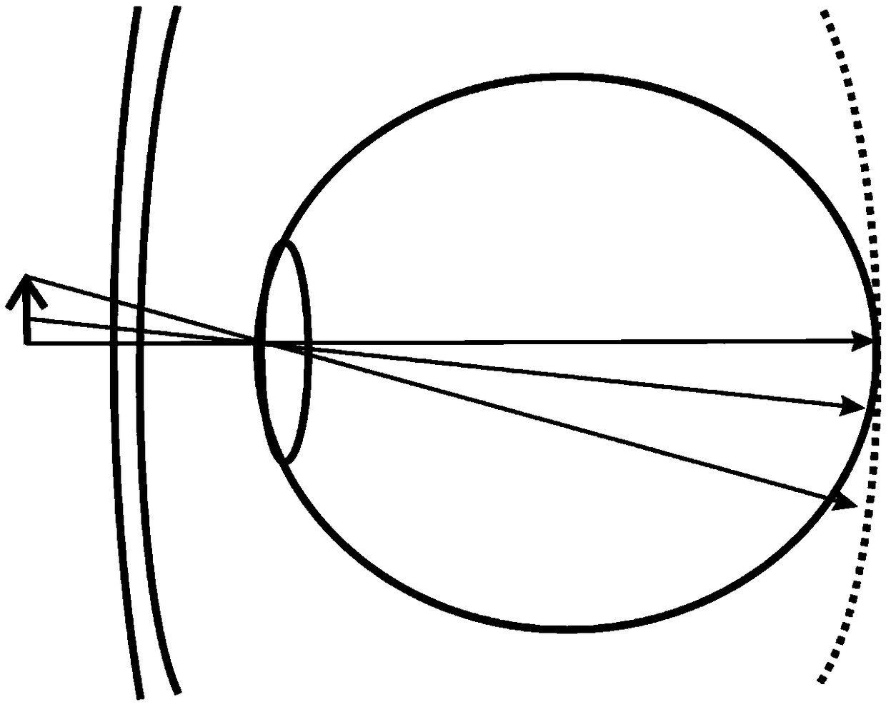 Vision control lens based on peripheral micro-lens, and glasses