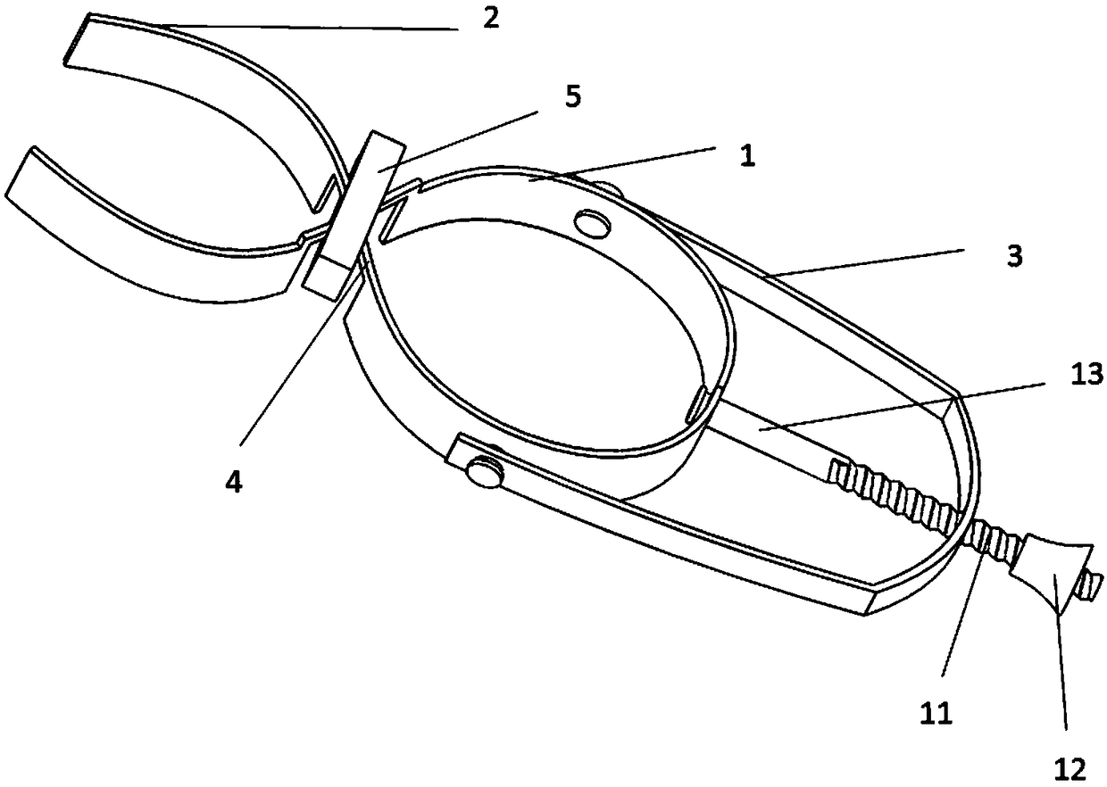 Adjustable fixed gingival separator for dental implant surgery