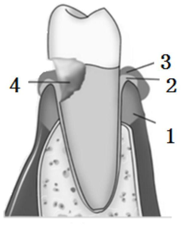 Composite materials and their preparation methods and applications