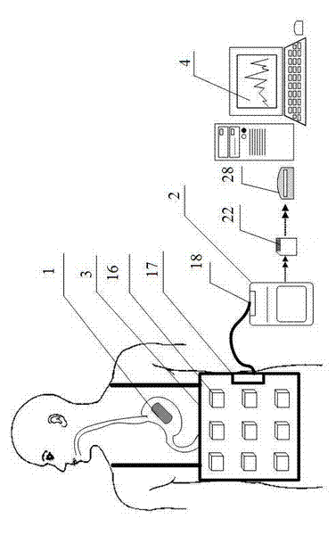 Total digestive tract emptying non-invasive examination system and treatment method of examination results