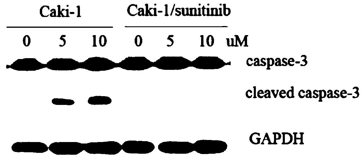 Application of pinin (PNN) inhibitor to preparation of drug for reversing drug resistance of transferable renal carcinoma cells to sunitinib