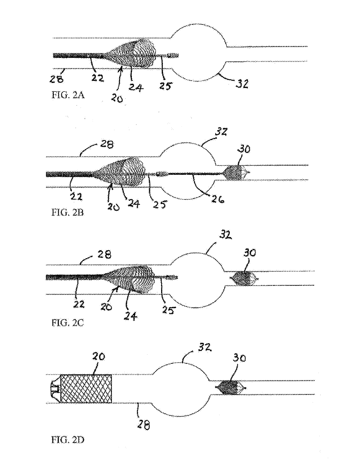 Endovascular occlusive device and associated surgical methodology