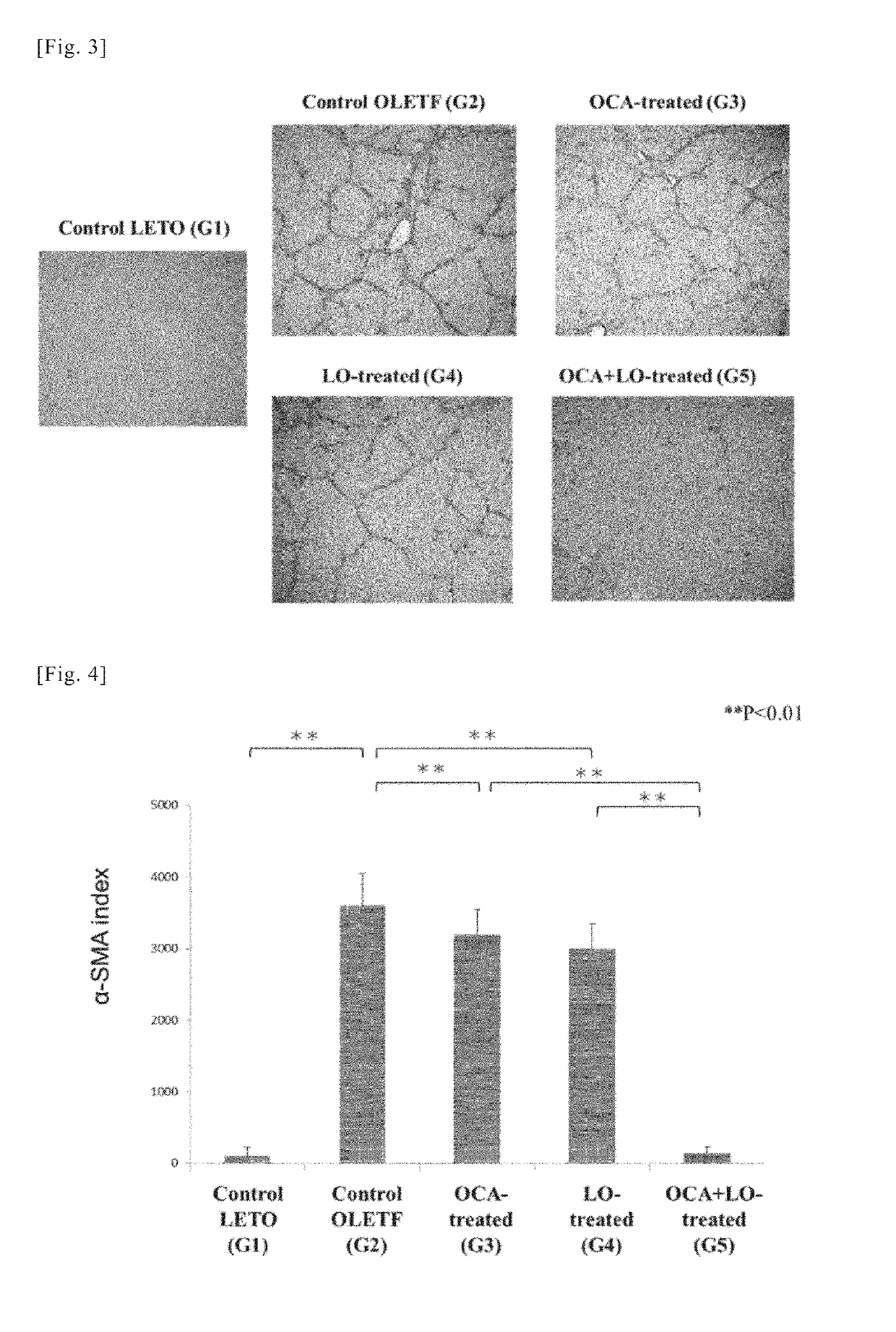 Medicine Obtained by Combining FXR Agonist and ARB