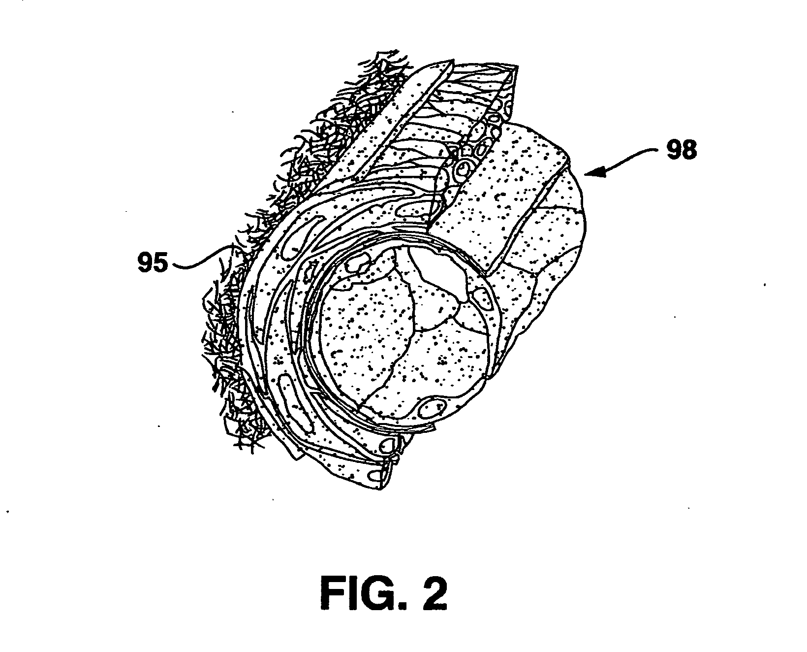 Compliant blood vessel graft