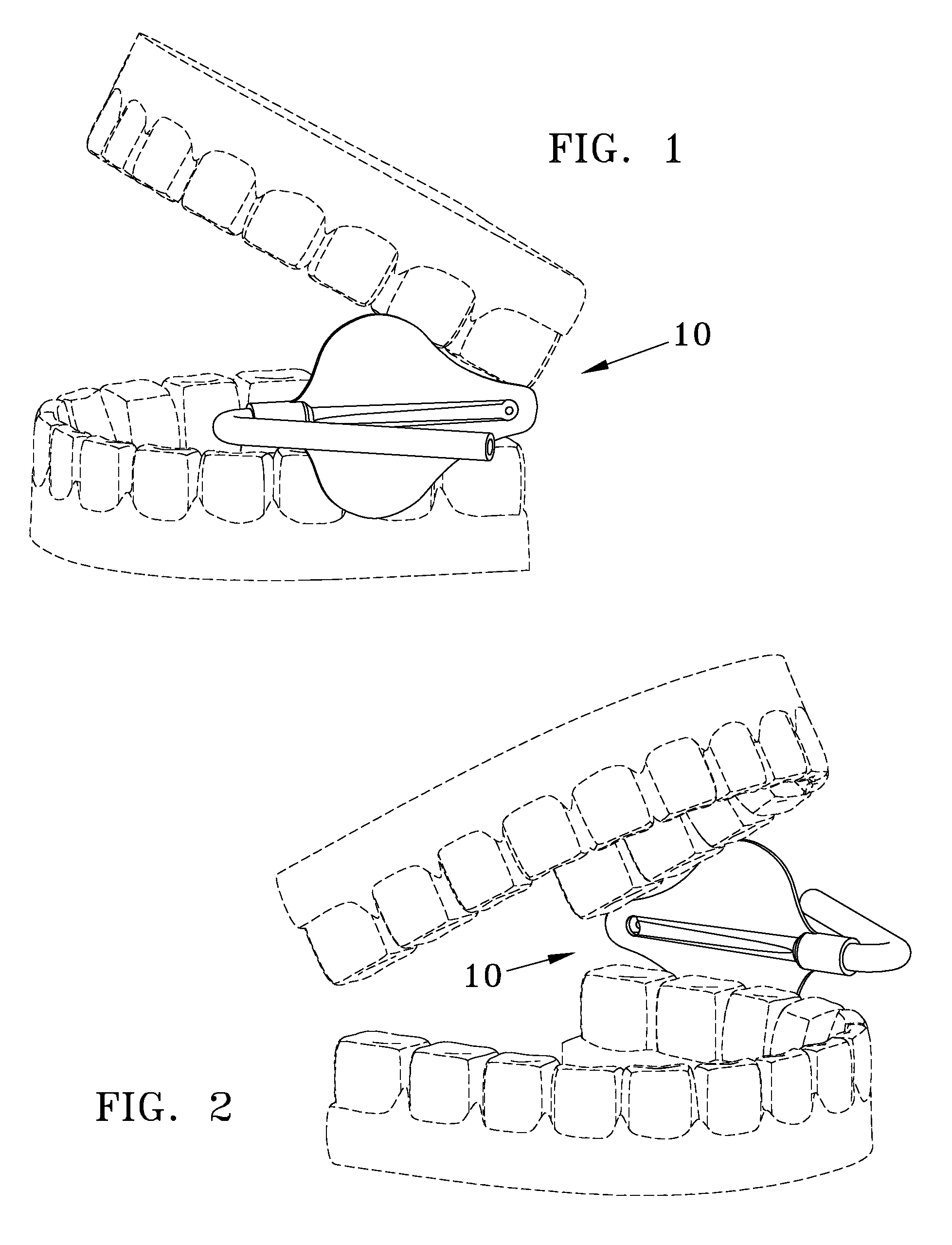 Oral cavity suction device