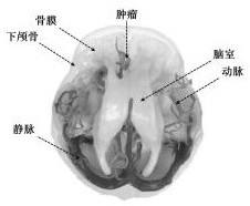 A kind of brain model and its preparation method and application