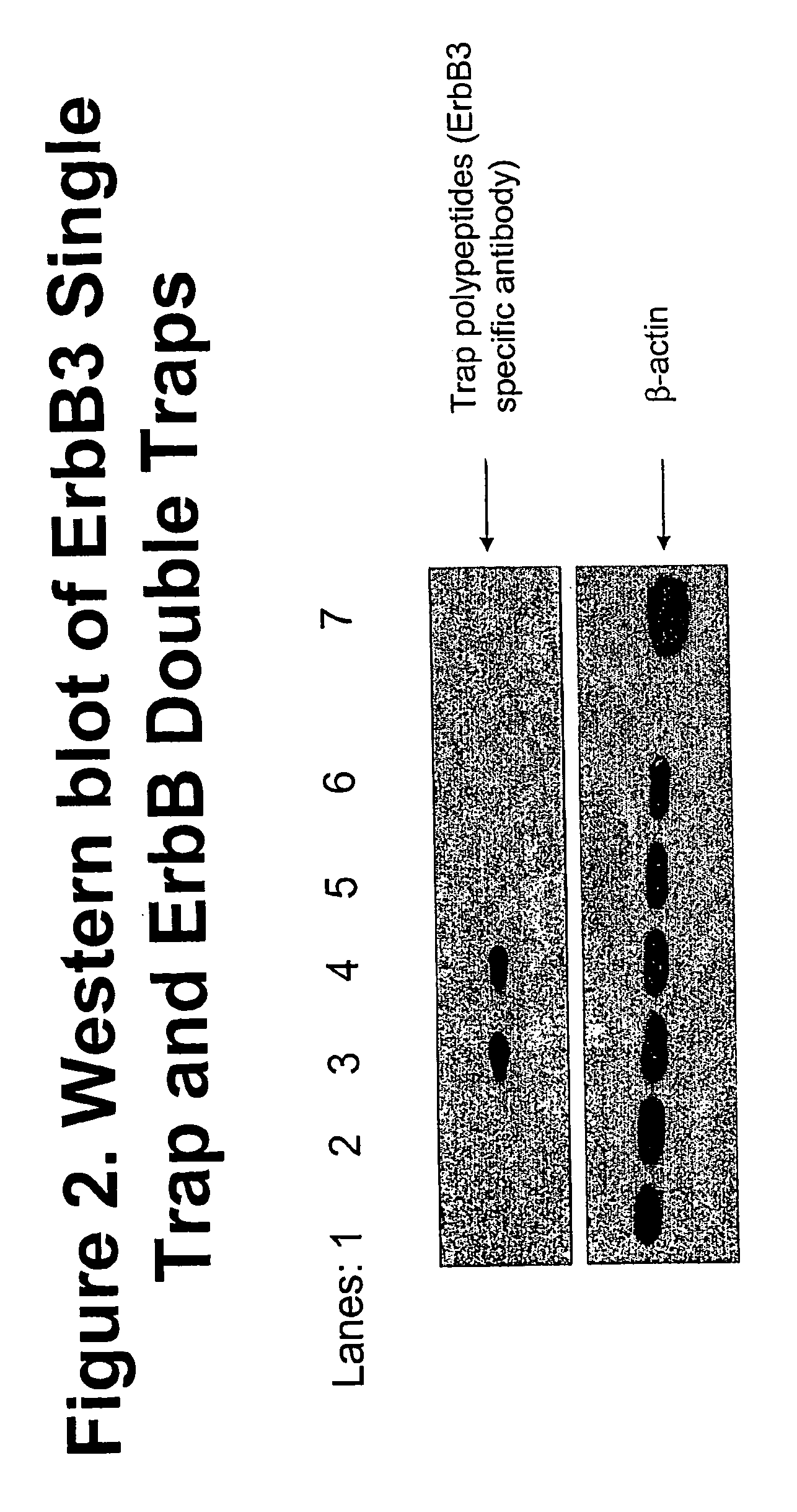 Tyrosine kinase inhibitor compositions and methods for manufacturing and using them in the treatment of disease