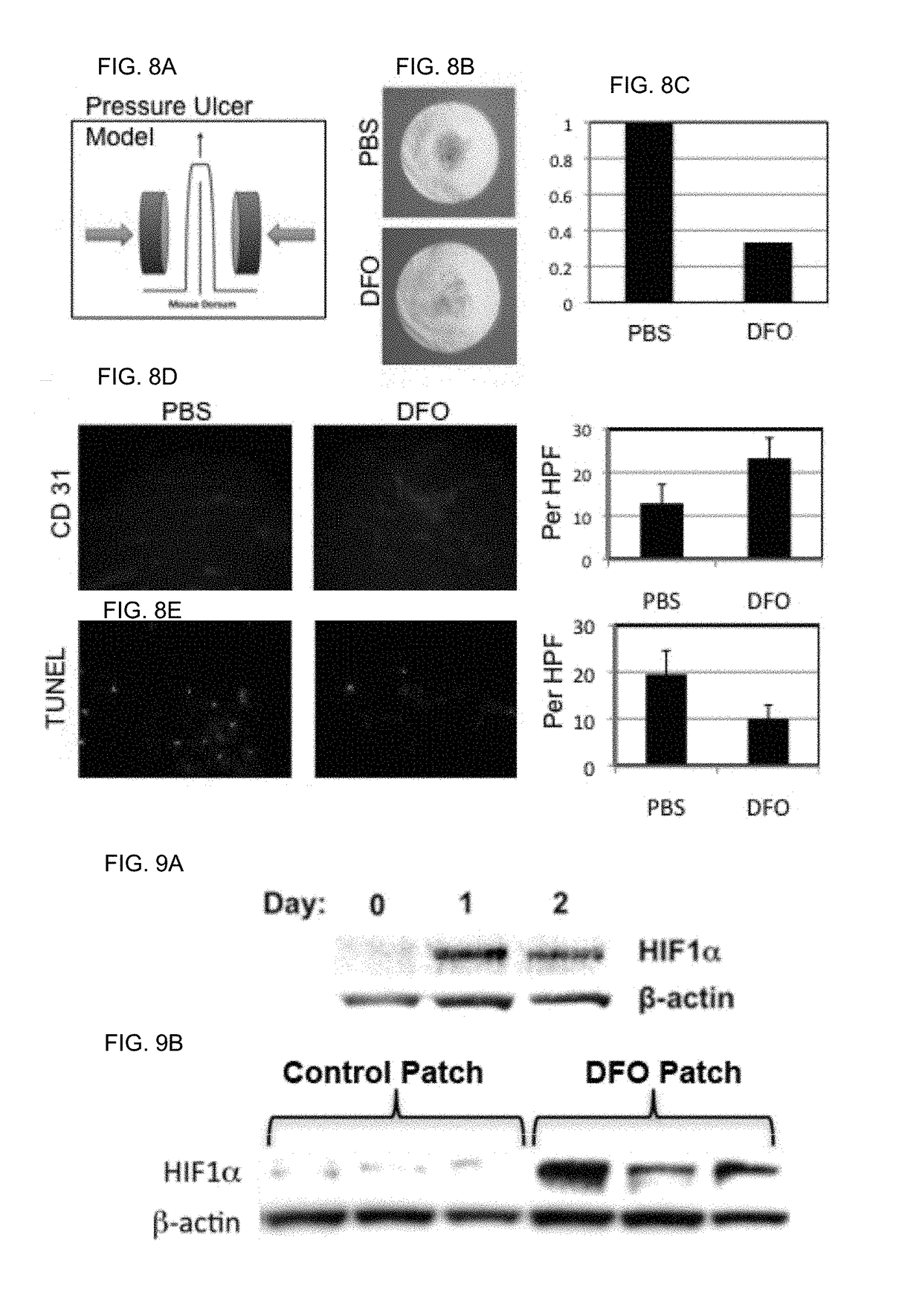 Topical and transdermal delivery of hif-1 modulators to prevent and treat chronic wounds