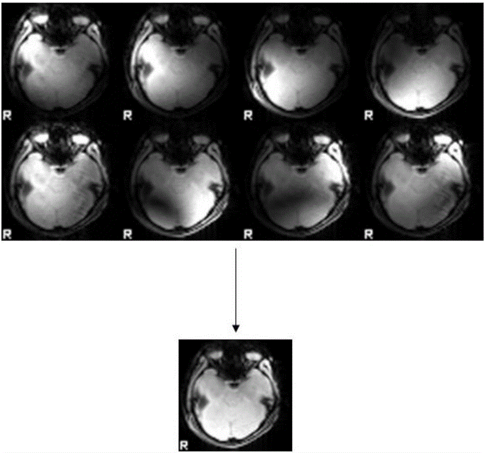 Method for correcting geometrical distortion antifact in fMRI based on field map