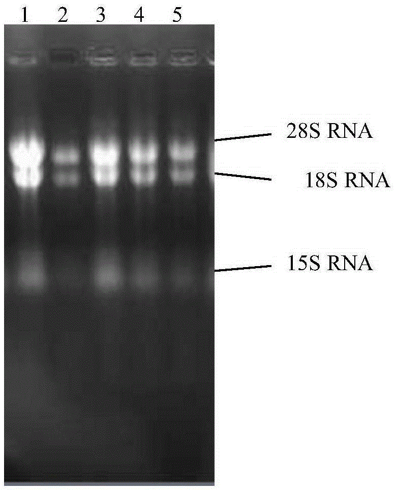 Cordyceps sinensis malate dehydrogenase a, coding gene and its application