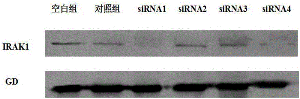 Small interfering RNA of people-targeted IRAK1 gene and application of RNA