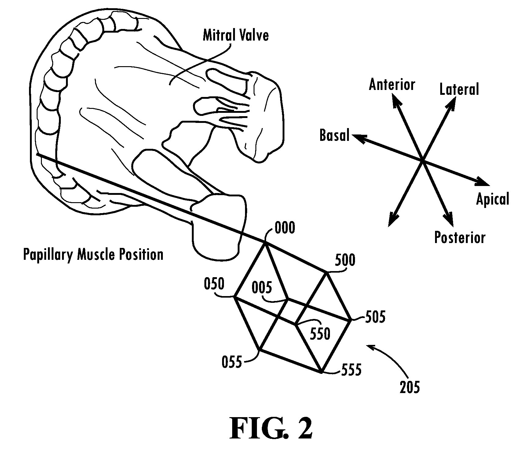 Papillary muscle position control devices, systems, and methods