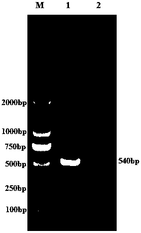 Porcine epidemic diarrhea, porcine deltacoronavirus dual inactivated vaccine and preparation method thereof