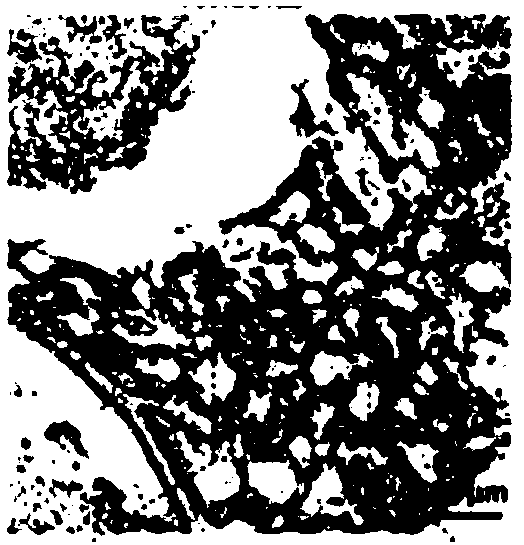 A colon cancer prognosis predictive marker and detection method thereof