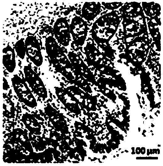 A colon cancer prognosis predictive marker and detection method thereof