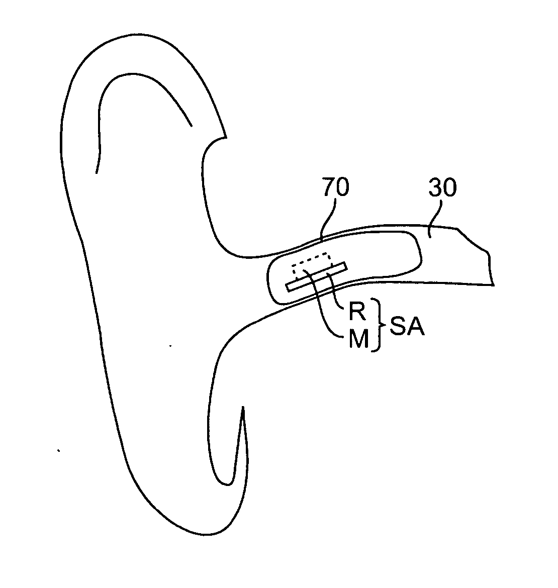 Remote magnetic activation of hearing devices