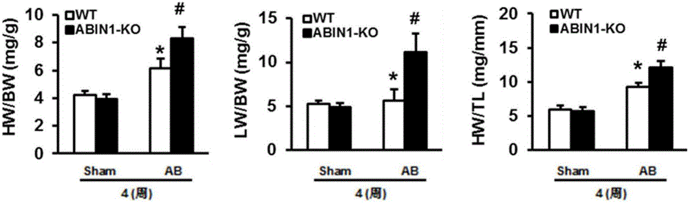 Function and application of A20 combined nuclear factor profilin 1(ABIN1) in cardiac hypertrophy treatment